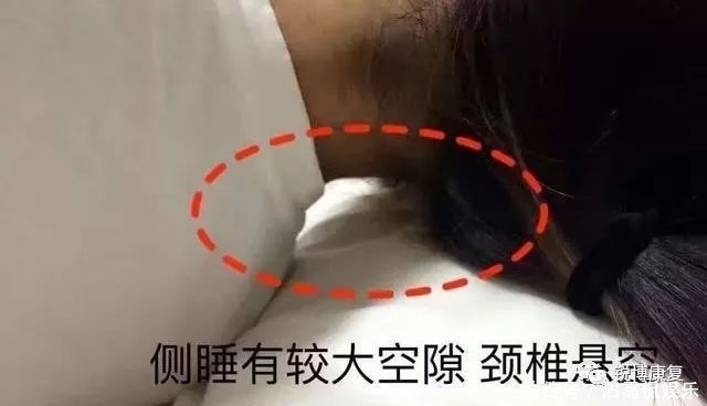 颈椎|枕头不适合也会导致颈椎病！教你如何挑选合适的枕头来保护颈椎！