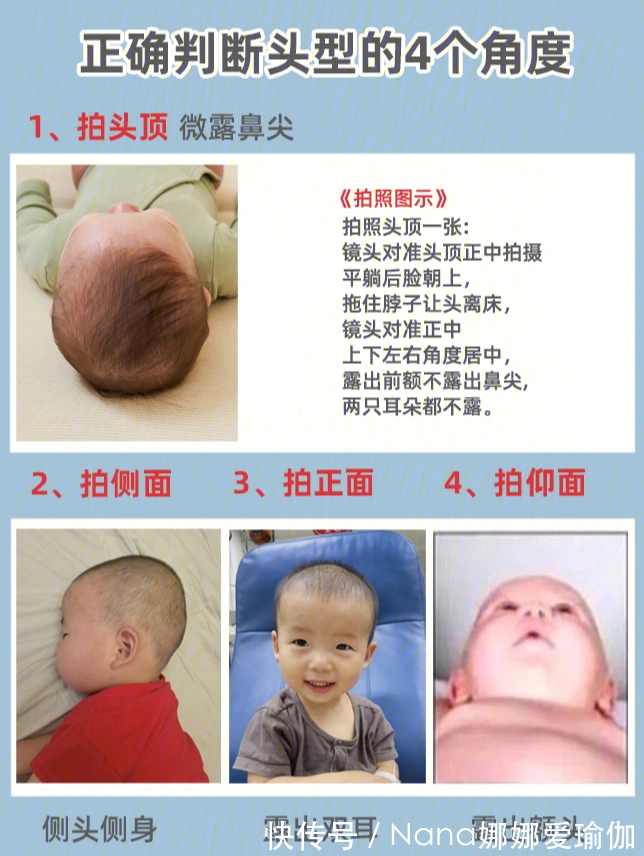 睡姿|宝宝睡圆头矫正头型,保姆级教程来了!