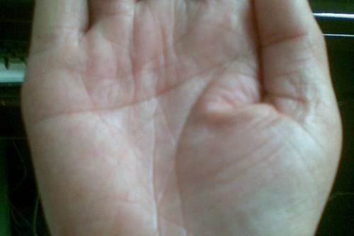 紫菜|你清楚“糖尿病”吗？如何降“血糖”？建议：常吃以下这5种食物