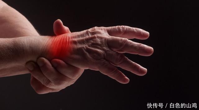  身体|身体出现4个表现，可能是尿酸高了，控尿酸，建议“3多2少”