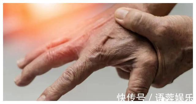 葡萄干|中医师临床常用的一款痛风食疗方,建议收藏