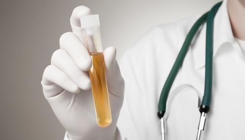 身体两个部位很臭,最好去检查一下肾脏,尿毒症可能已经找上你