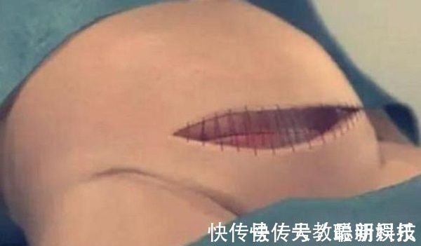 孕妈|剖腹产只是“挨一刀”就完事看完手术全过程,忍不住心疼女人