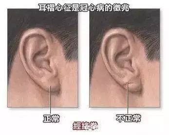 黄帝内经·灵枢|“长寿脸”有这9个特征,“长寿招”不外乎这6个习惯,你占几个?