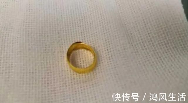 食管|乐极生悲!满月宝宝戴5只金戒指后吞下一只!这习俗太危险