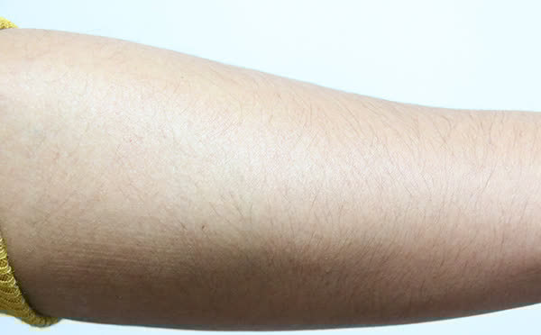 脱裤子时，为何会从腿上掉下来很多皮屑？是缺了什么营养素？