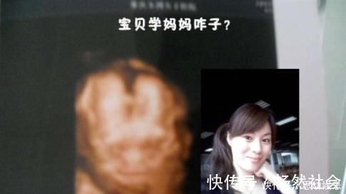 建档|怀孕后孕检口诀1建,1筛,2查,3超少不了,宝宝健康怀里抱