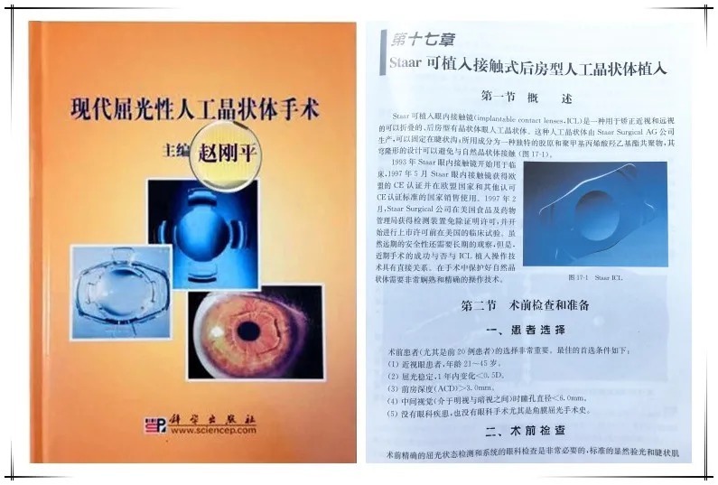 近视手术|这种可逆的近视手术适合我吗?