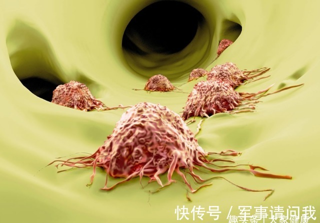 癌症患者|癌症能活多久?医生总结:生存期超过10年的癌症患者,有5种共性