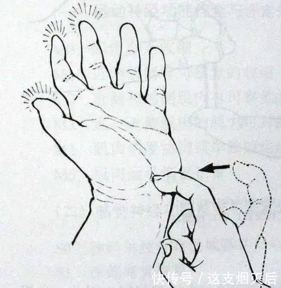 手部麻木的7种常见病因、如何鉴别及治疗