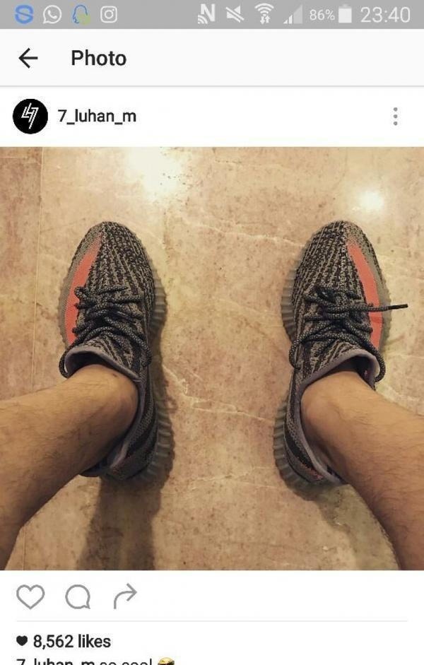 看看吧,明星身上最尴尬的腿毛有多少