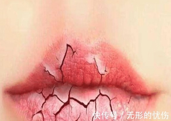 艳红 有多少女孩不会涂口红,还整天顶着一嘴艳红认为自己挺美!