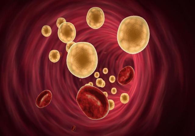 丰隆穴|血脂高的人，眼睛可能有3个症状，若没有，说明血脂控制的还不错