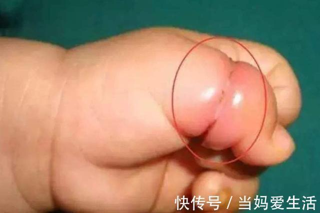 手套|95后母婴店员:店里的“3样产品”,我从不给宝宝买,你用过吗?