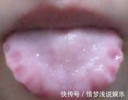 祛湿|早晚吃一物,排出体内多年湿气,健康又漂亮,神奇!