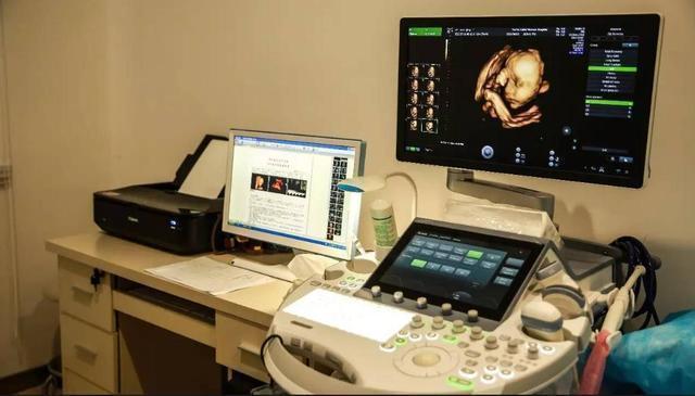 四维彩超|怀孕后总是小心翼翼闯过了这6关孕检,孕妈就可以松口气了