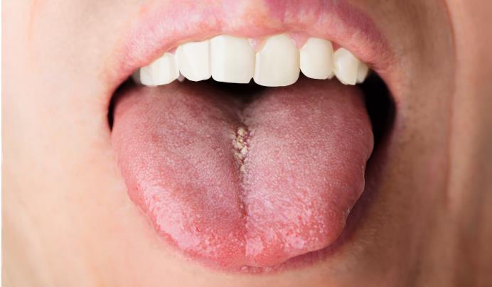 中成药|湿邪不祛,吃再多补品也无济于事!祛湿中成药百科,请收好