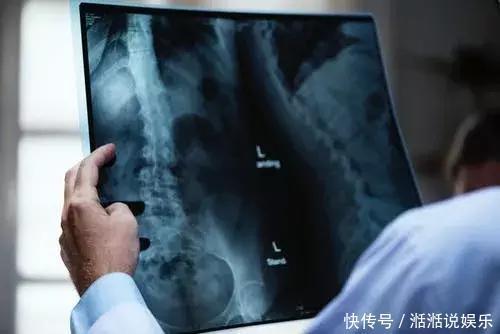 夏季第一豆不是绿豆而是它！降血糖、防中风常吃好处多，别错过