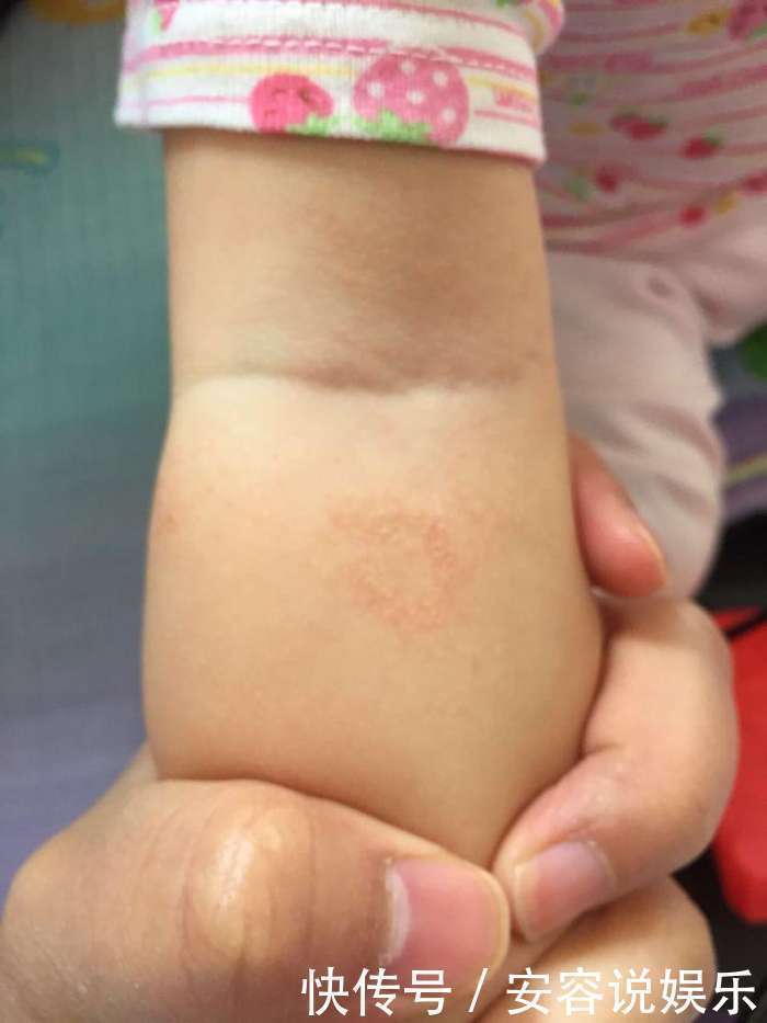 宝宝|1岁多的宝宝大腿一碰就哭,医生检查后从腿里取出了这个东西!