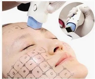 有效率|夏季适合做热玛吉吗?丨科普篇