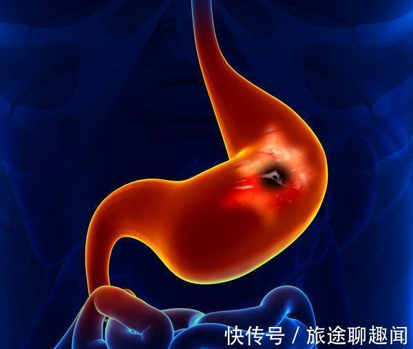 蔬菜|医生建议:想养胃的人,尽量避免吃这几种蔬菜,胃或会为你点赞