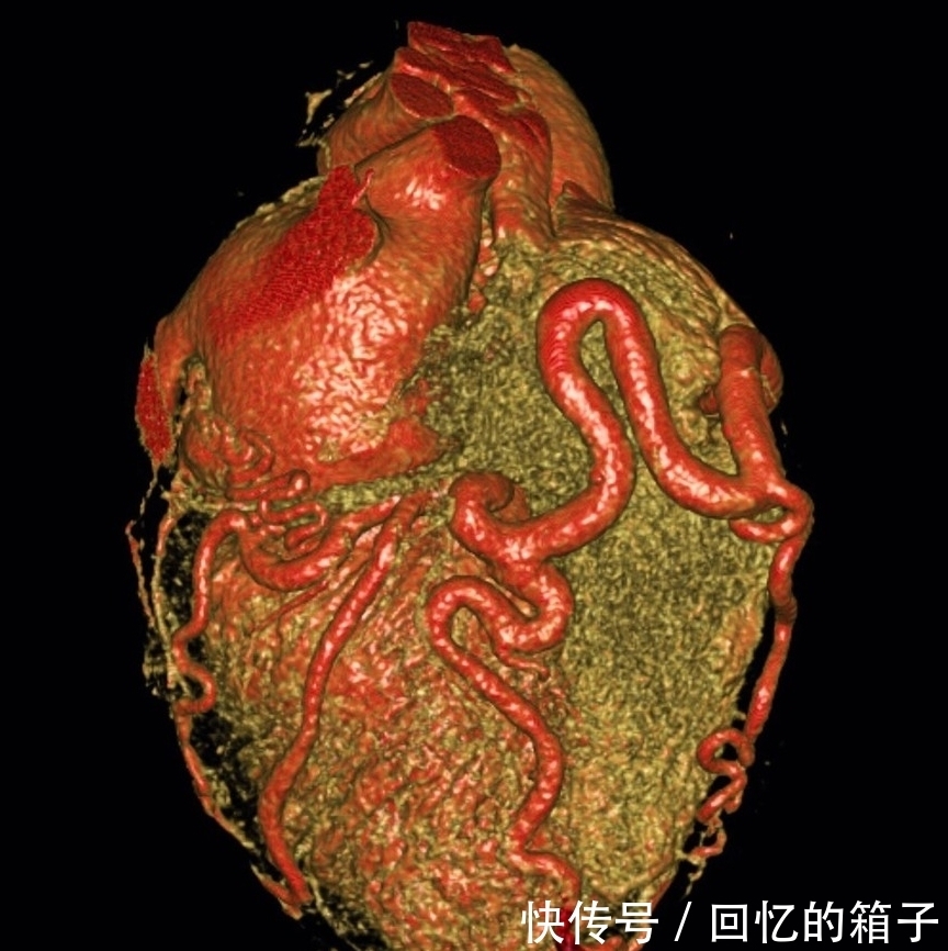 预防冠心病的发生及进展,给所有三高和冠心病患者三点建议,收藏