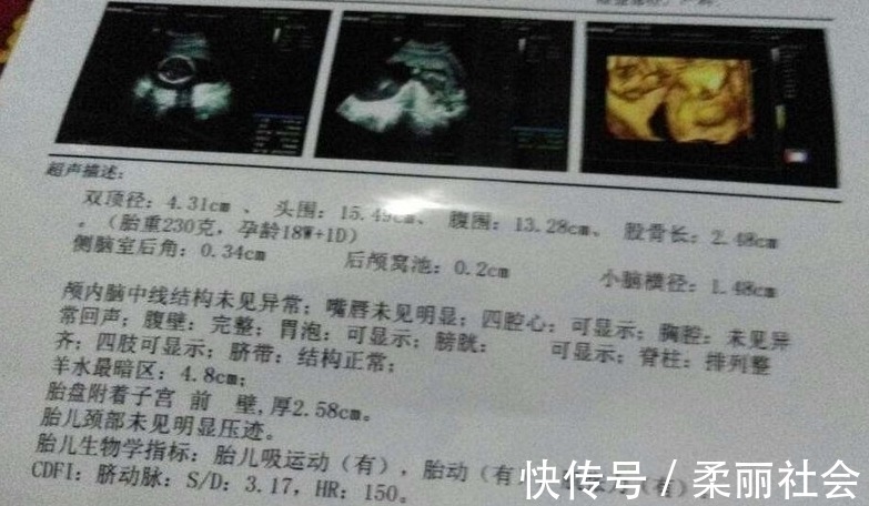 四维彩超|四维彩超单上4个数据,暗示了胎儿秘密,你知道了吗?