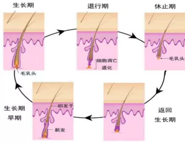 雄激素性脱发|脱发人士必看：拯救发量的N个办法，到底哪个最靠谱？