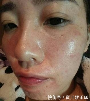 药店|药店的一粒它,大妈每天用它抹脸,坚持五次祛斑,皮肤白嫩有弹性