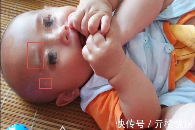 睡眠质量|若孩子肚子里有蛔虫,会出现这些“信号”,家长速查你家娃有吗