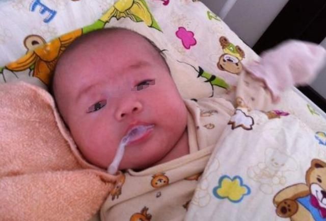 发育|别再让宝宝这样睡了?小心睡成了“舟状头”,影响宝宝发育