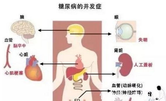 糖尿病患者|三种维生素，预防糖尿病及其并发症，有助于糖尿病逆转