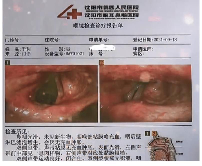 嗓子|舞帝利哥保平安透露病情，在做息肉术前准备，短时间内无法开播