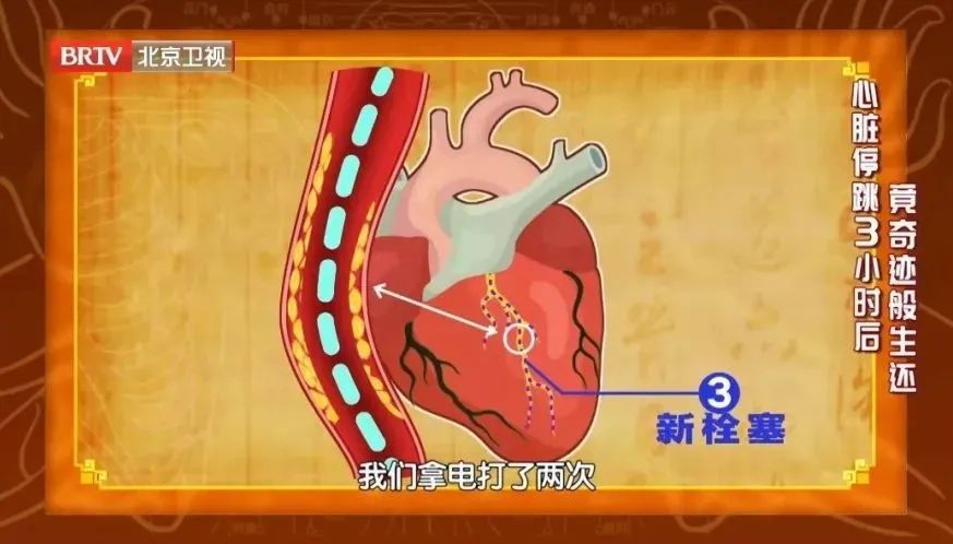 安贞医院|早晨醒来，第一件事竟然不是急着起床？院长分享3大“法宝”，护血管、强心脏，冬天尤其适用