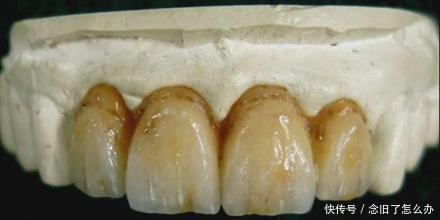 牙不好,疾病满身跑,中医教你一套护牙指南,牙齿更牢固