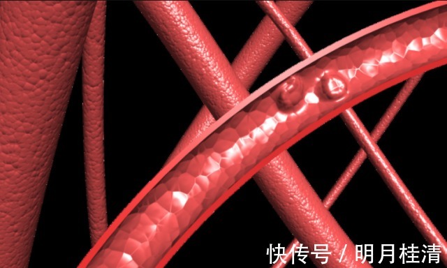 糖尿病患者|糖尿病人能喝酒吗或许大部分人想错了，难怪血糖一直不稳定