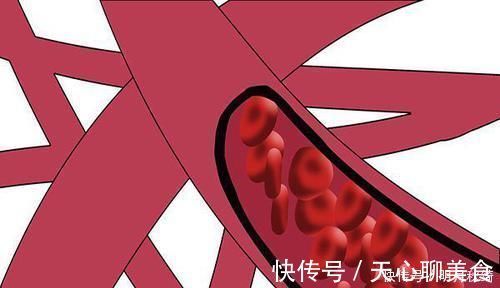 人体|“天然”阿司匹林找到了,白开水里加上它,血管弹性十足,人长寿