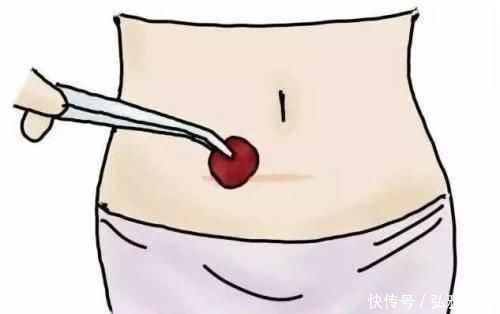 性生活|剖腹产后坚决不能做5大危险动作,产妇别不当回事,否则自己受罪