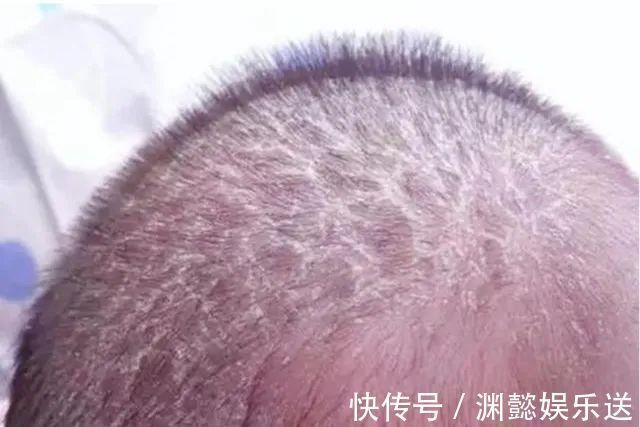 新手爸|婴儿身上哪几个部位再脏也不能洗新手爸妈要知道,洗错会害了娃