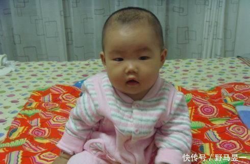 积食|儿科医生平时多摸摸娃这3处,想不聪明都难,以后会感激你