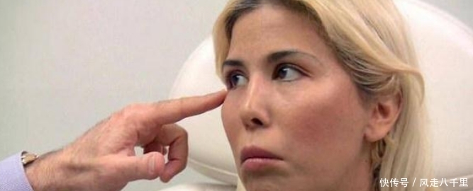 整容|女子花重金整容，一年经历13次整容手术，整容前后判若两人