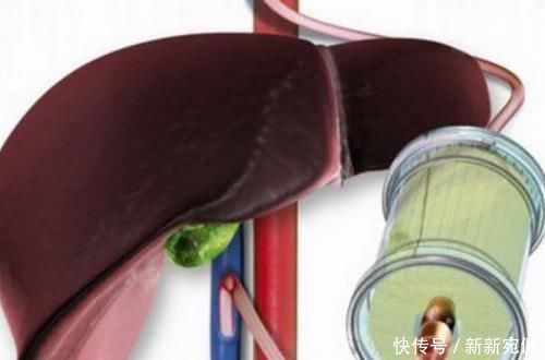 维生素肝不舒服的人,每天多吃点“它”,排毒降肝火,肝脏更健康