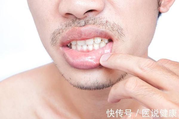 肝胆火旺|早上起床经常出现口干口苦现象时，注意可能和3个因素有关