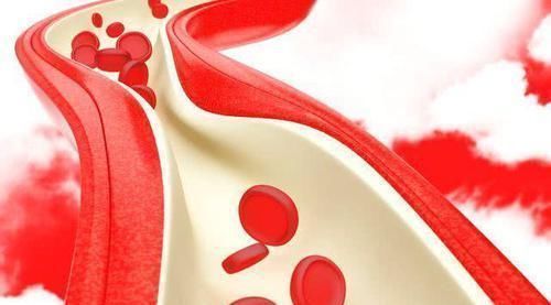 胆固醇|血脂高的人,晚上睡觉或有4个表现,若都没有,说明血液还未黏稠