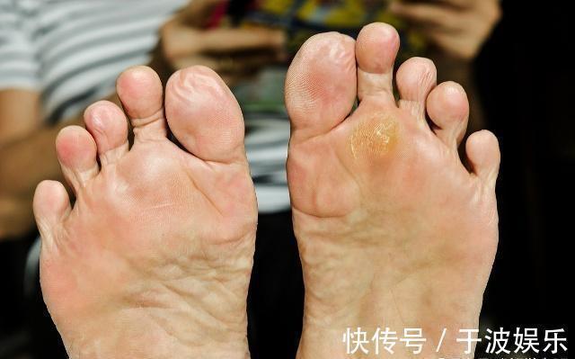 脚底|长寿的人,脚上一般有这二个特征,怎样可以加入长寿的队伍中