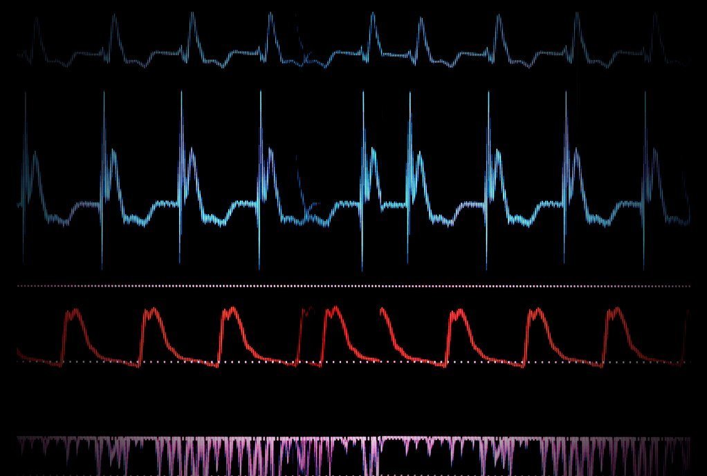 血压|高血压,不只是吃降压药就完了,合理降压、长期达标要知道这6点