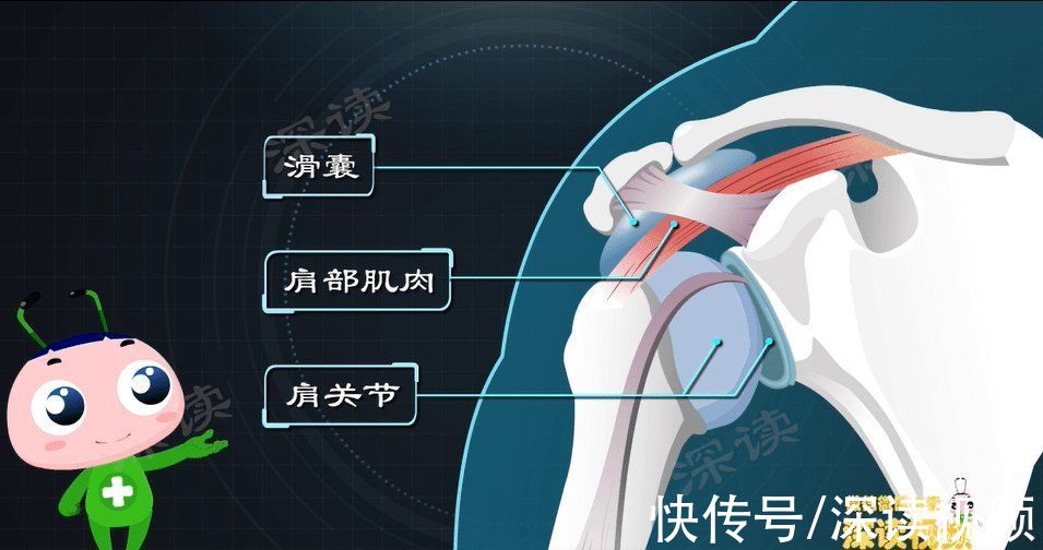 肌肉|肩膀疼痛？胳膊难抬？搞不好会残废？长期加班的亲，小心肩周炎