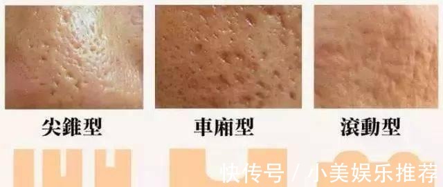 底妆|为什么年龄越大毛孔越大预防毛孔粗大做对这3件事即可,超实用