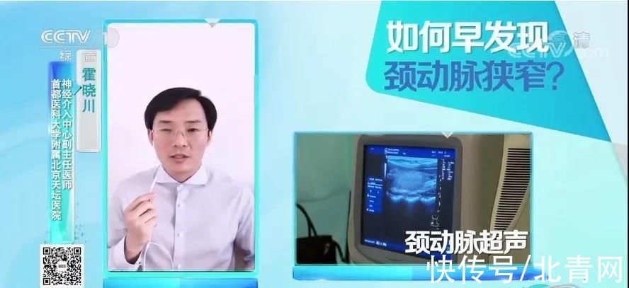 颈动脉斑块|它是最怕堵的一根血管，严重可致命！4种方法帮你预防