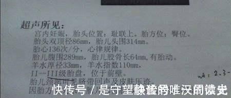 胎心监护|孕期说有这几个信号,腹中的胎儿,十有八九是个小千金